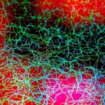 brain3