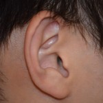 ear