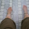 足底腱膜炎（そくていけんまくえん）の治療法