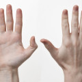 甲状腺機能亢進症の症状は伸ばした手でわかる