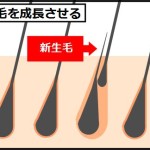 薄毛改善