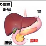 膵臓がんの症状