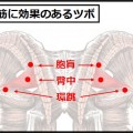 梨状筋ストレッチで坐骨神経痛や冷え性が改善