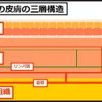 皮膚がん