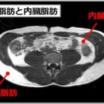 皮下脂肪の落とし方