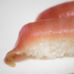 突然死の原因