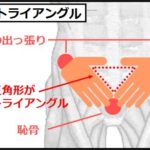 骨盤トライアングル