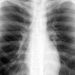 x-ray (480×311)